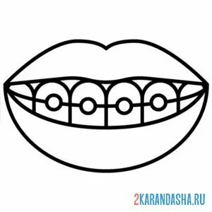 Раскраска рот зубы брекеты