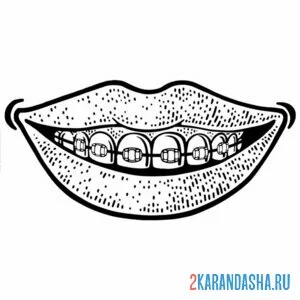 Раскраска брекеты рот зубы